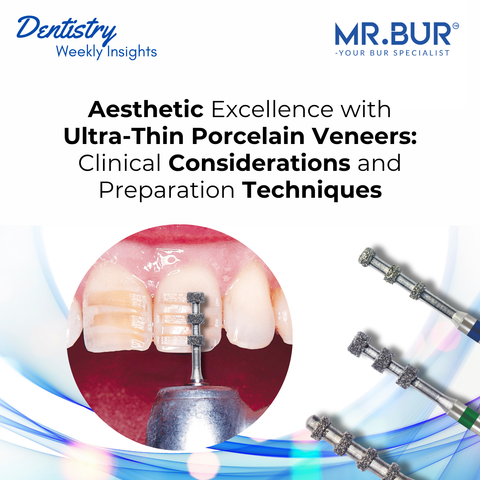 Mr. Bur Depth Marker Bur used for aesthetic excellence with ultra-thin porcelain veneers, ensuring precise enamel reduction and natural-looking restorative outcomes.