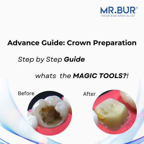 Advance guide 10 steps to posterior crown preparation with Mr Bur burs ensuring accuracy efficiency and predictable outcomes.