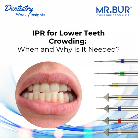 MR.BUR orthodontic article cover showing crowded lower front teeth and interproximal reduction (IPR) diamond burs used for enamel reduction during teeth alignment.