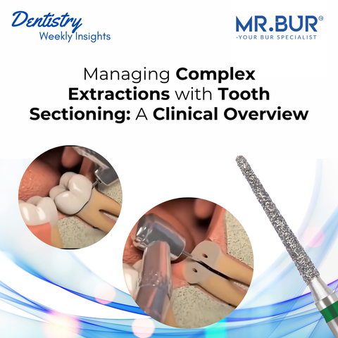 Mr. Bur Tooth Sectioning Diamond 77L Bur for precise crown and root sectioning in third molar extractions, offering deep posterior access with smooth, controlled cutting.