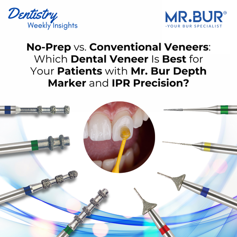 Comparison of no-prep and conventional veneers using Mr. Bur depth marker and IPR burs for precise enamel reduction and optimal veneer placement.