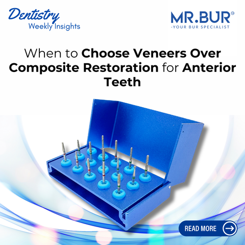 Mr Bur Veneer Preparation Kit FG featured in dentistry insights about choosing veneers over composite restorations for anterior teeth.