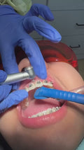 MR.BUR Interproximal Reduction Dental Bur. Available in 0.3mm, 0.4mm, 0.45mm, and 0.5mm for maximize precision and efficacy in interdental space adjustment and enamel reduction.