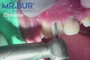 Mr. Bur Crown Cutter Hybrid Twister Super Coarse Diamond Bur FG ensures fast, precise crown removal with superior cutting efficiency and durability for optimal dental procedures.